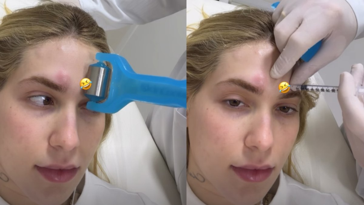 Virginia desabafa: "Horrível", fala sobre seu tratamento médico